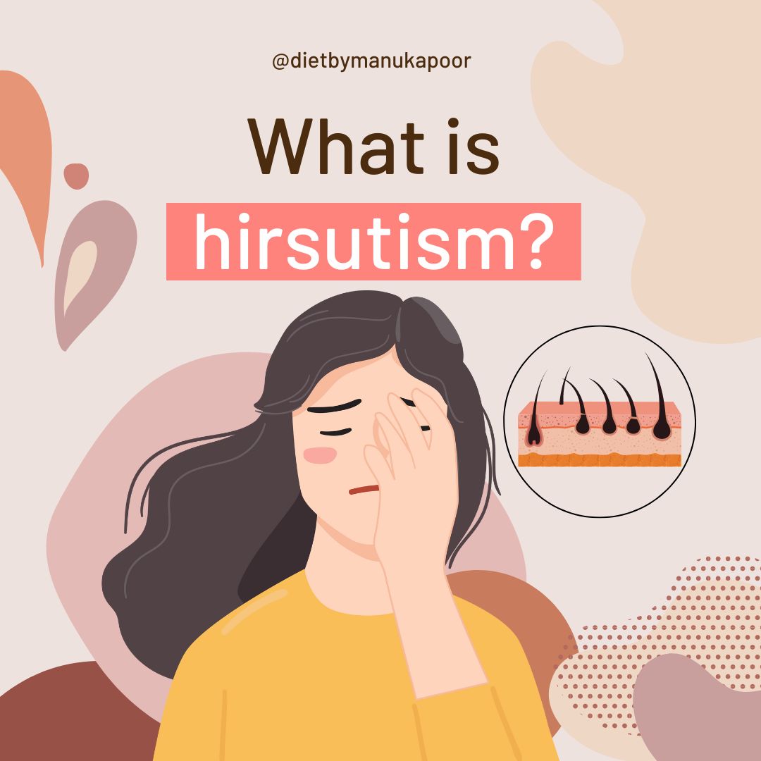 What is Hirsutism? 